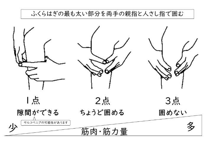 插图：环形测试（用双手的拇指和食指围住小腿最粗的部分）